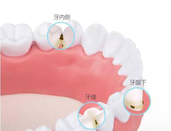 还在为口腔问题发愁？便携冲牙器用过一次，再也不想离开它！