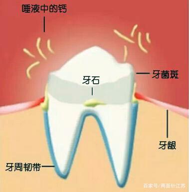 牙菌斑怎么去除，仅靠刷牙是不够的，还需要这个小帮手